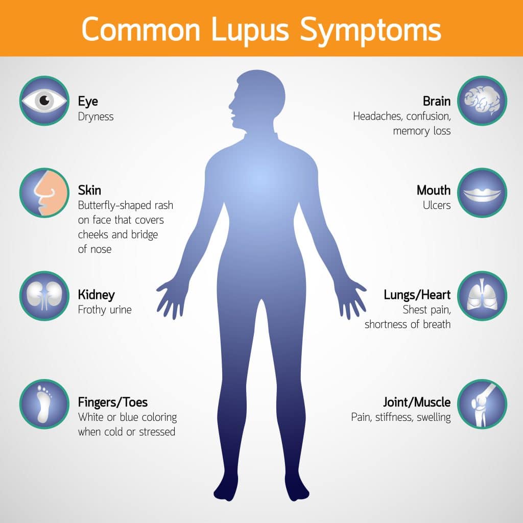 What Causes Lupus Pompa Program