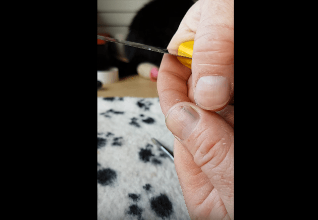 splinter under nail grow out New Pimple Popping Videos