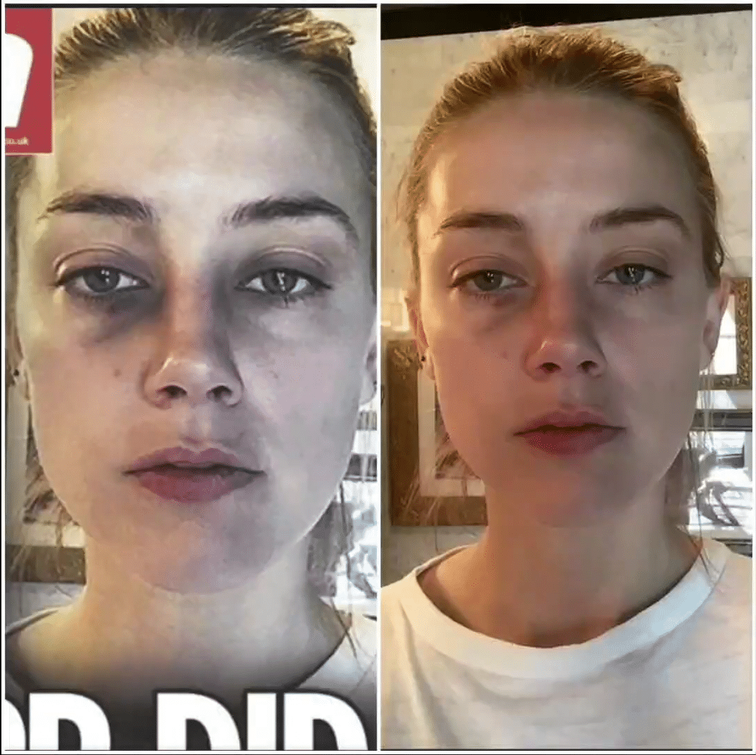 The Sun Amber Heard fake injuries/abuse pictures