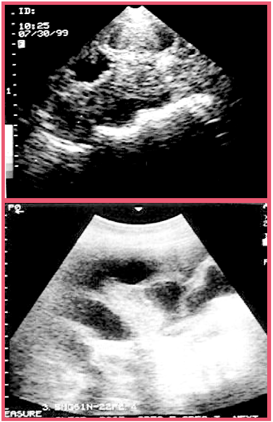 Using realtime ultrasound for pregnancy in swine Pork Information