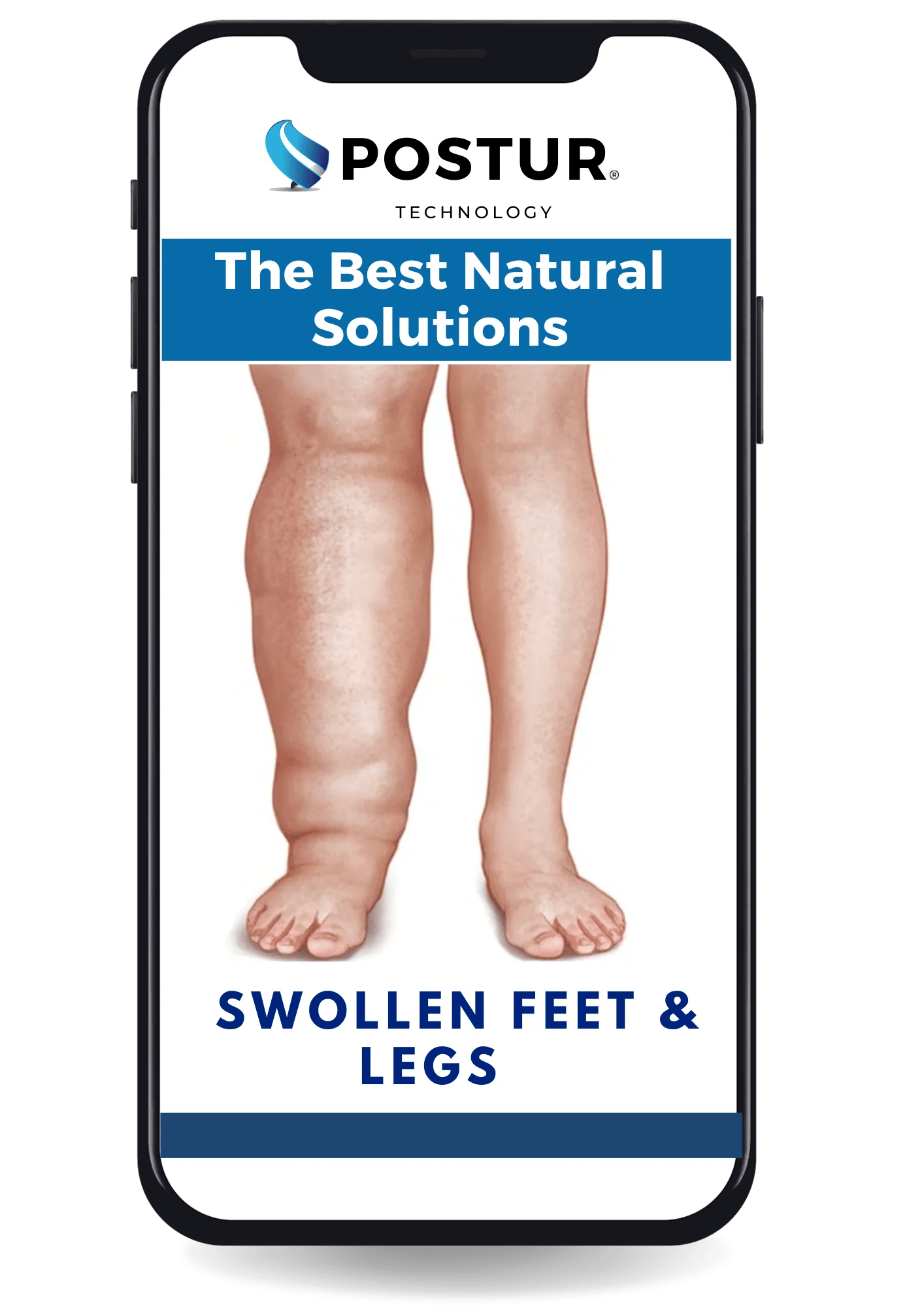 Receive Our eBook Swollen Feet & Legs The Best Natural Solutions