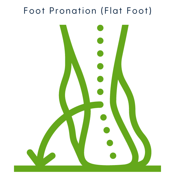 The Effect Weak Hip Abductors Can Have on Foot Pronation.