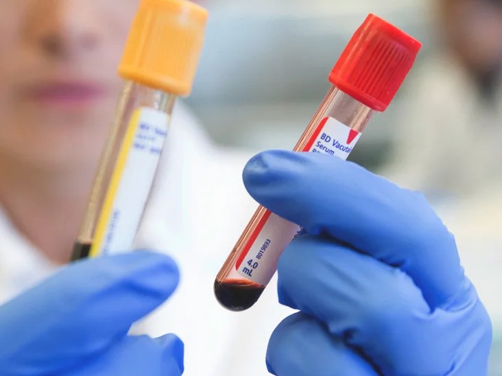 How Many Vials In A Pint Of Blood PostureInfoHub