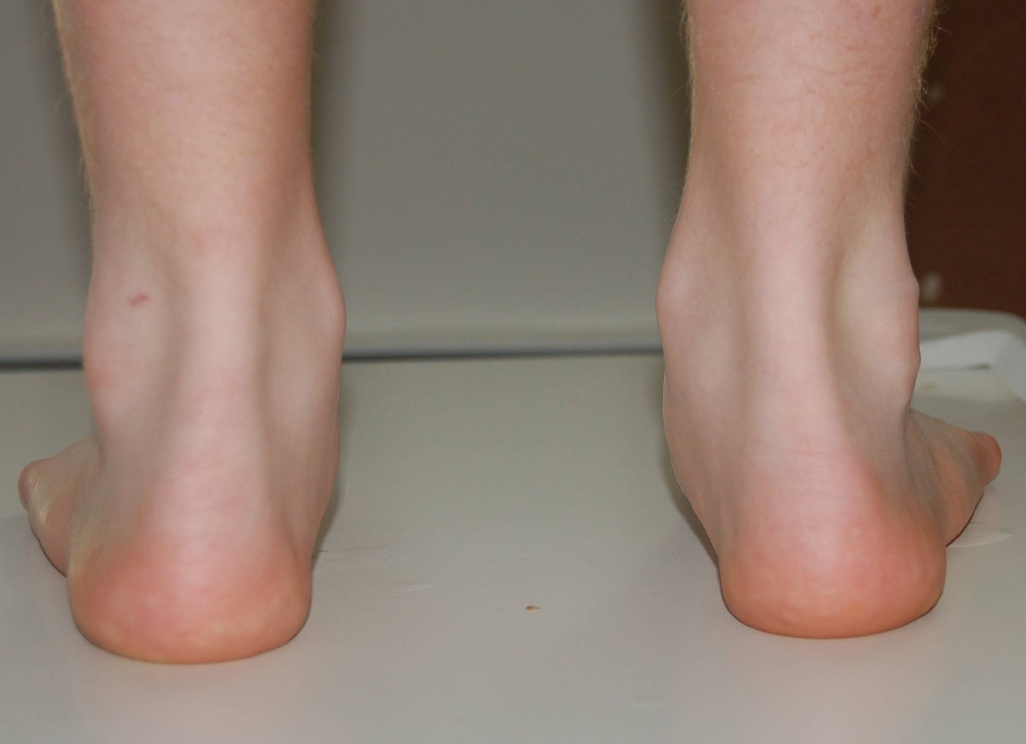 How to Prevent Ankle Injuries Posturepro