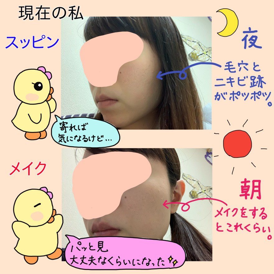 みかん肌で悩んだ私が15年以上おこなっている対策は酵素洗顔 ぴのりブログ