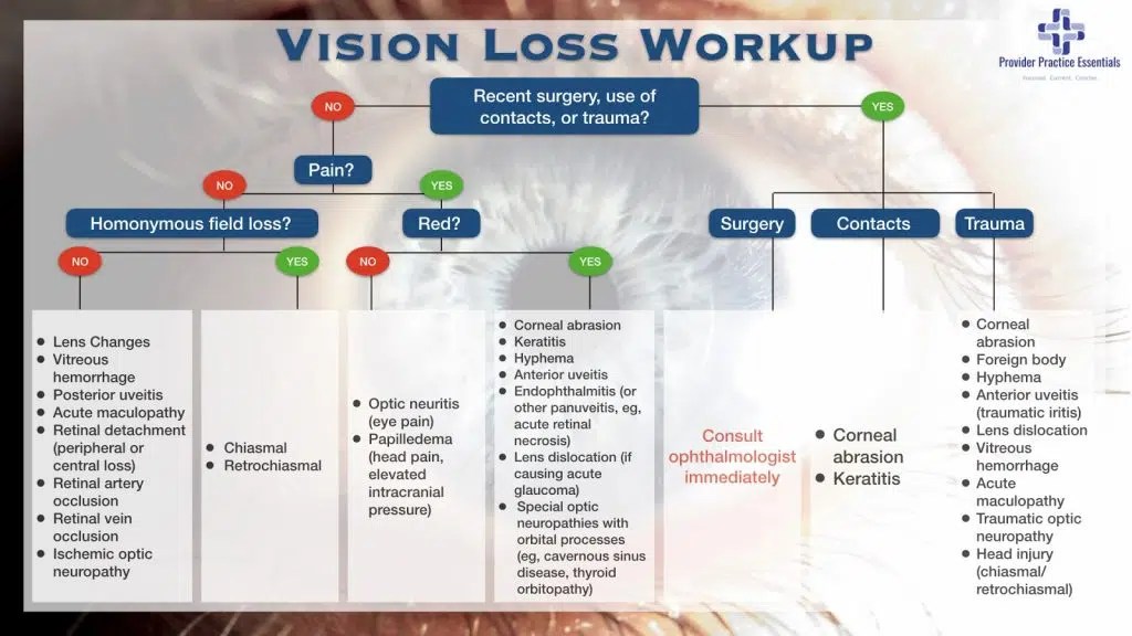 Monocular Painless Vision Loss Provider Practice Essentials