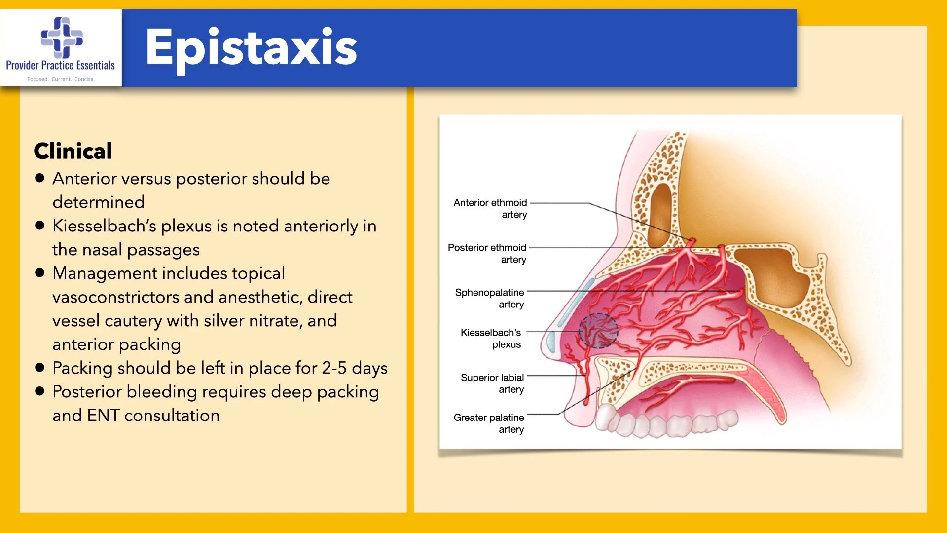 Epistaxis Management SCOPE
