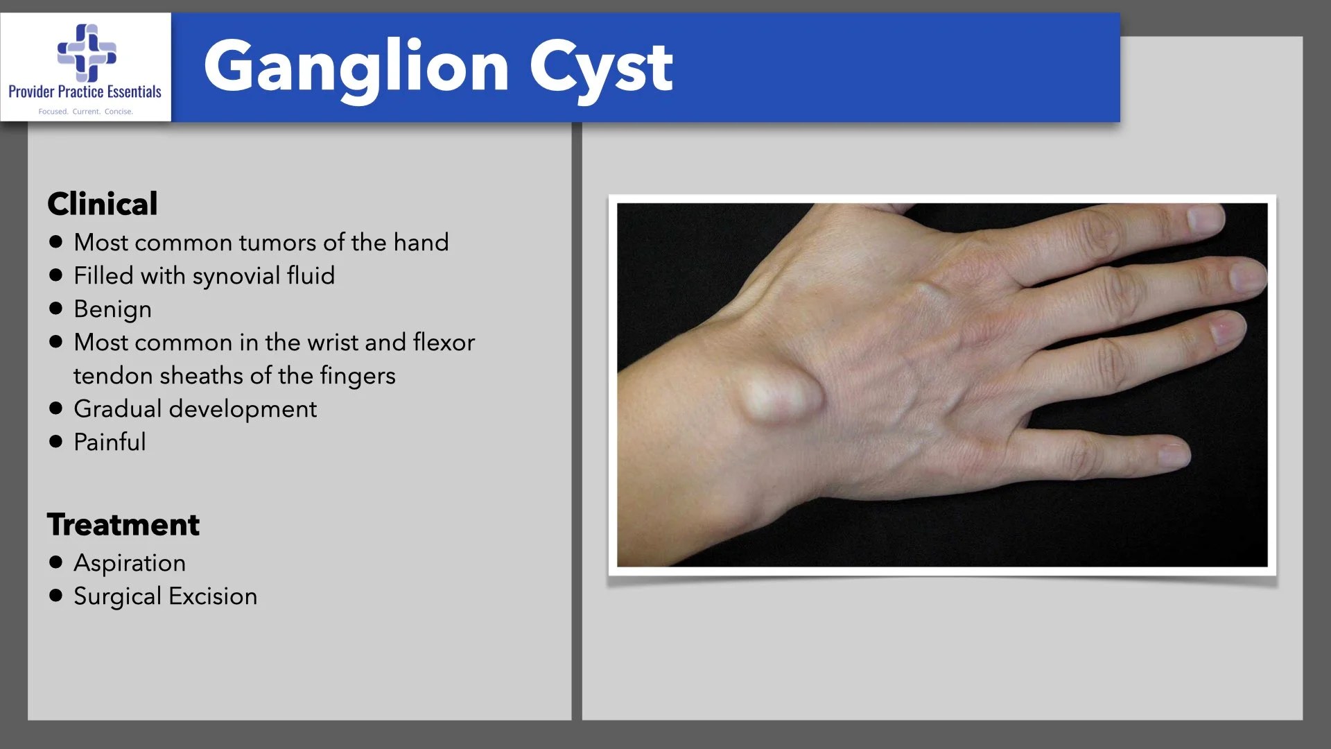 Common, NonEmergent Hand and Wrist ConditionsPart 2