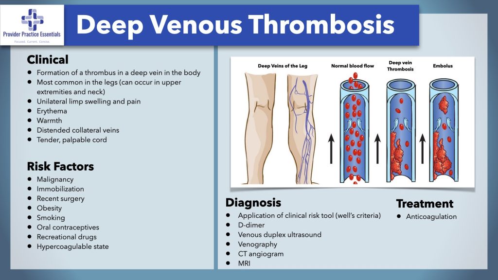 Deep Venous Thrombosis (DVT) Diagnosis and Optimal Treatment SCOPE
