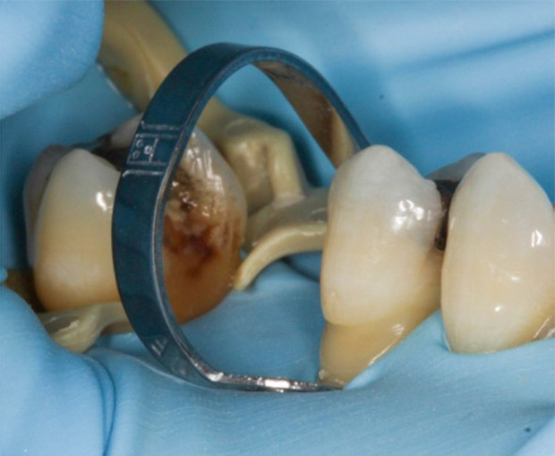 Rubber Dam Hands on Isolation Course Buying or Starting a Dental