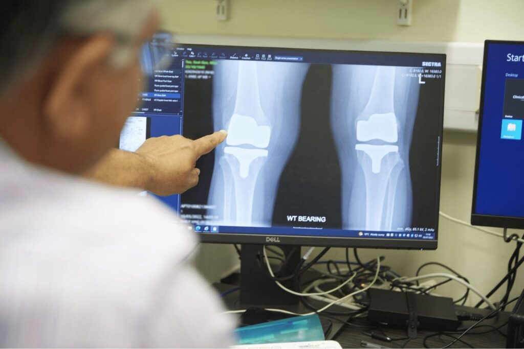 How much does a knee replacement cost? Practice Plus Group