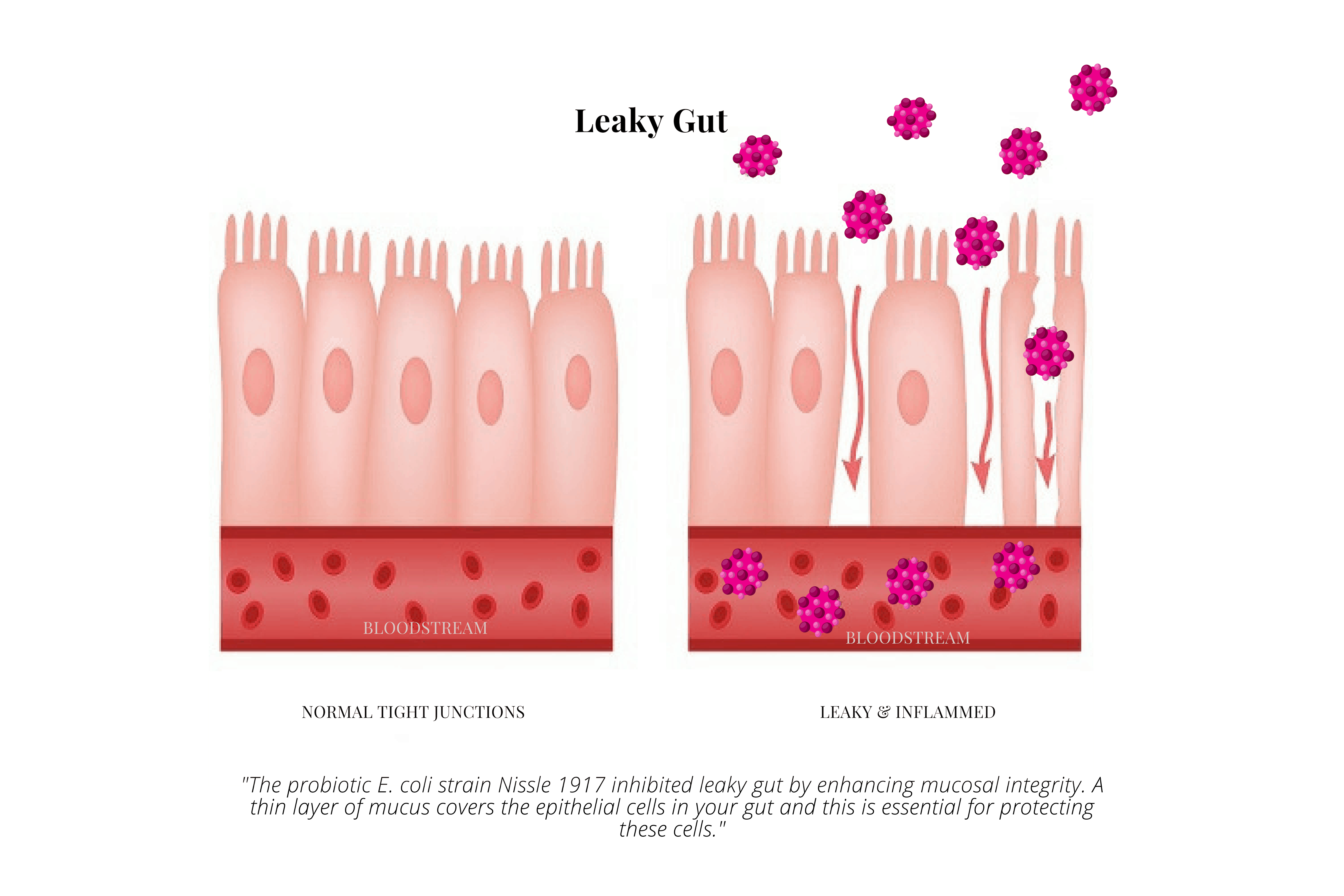 The Ecoli Strain 'Nissle 1917' (Mutaflor) A Powerful Probiotic