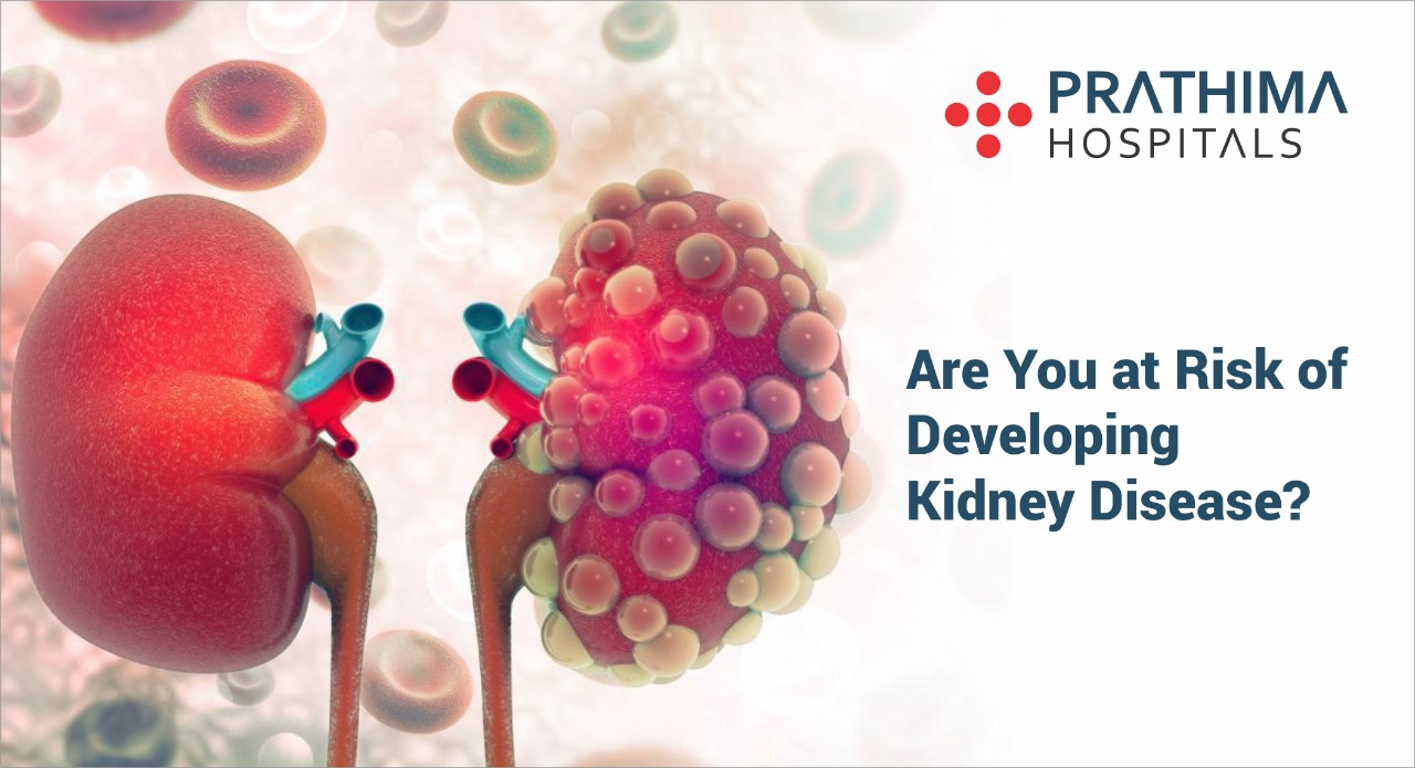Are You at Risk of Developing Kidney Disease? Best Hospital in