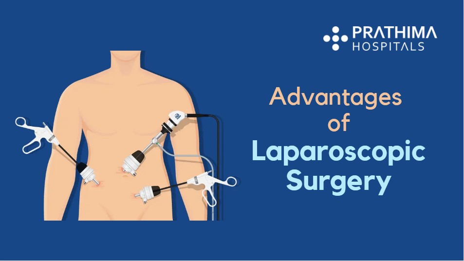 Advantages of Laparoscopic Surgery Best general surgeon in Hyderabad