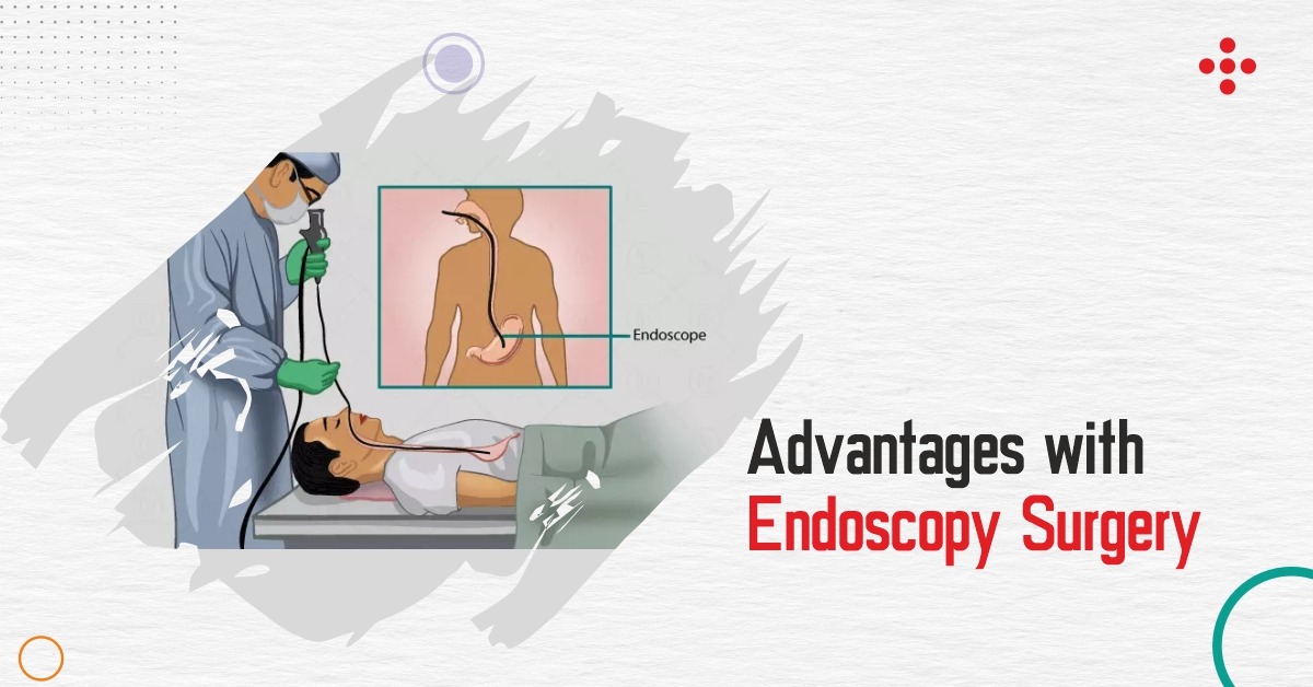 Benefits of Endoscopy Surgery Advantages with Endoscopy Surgery