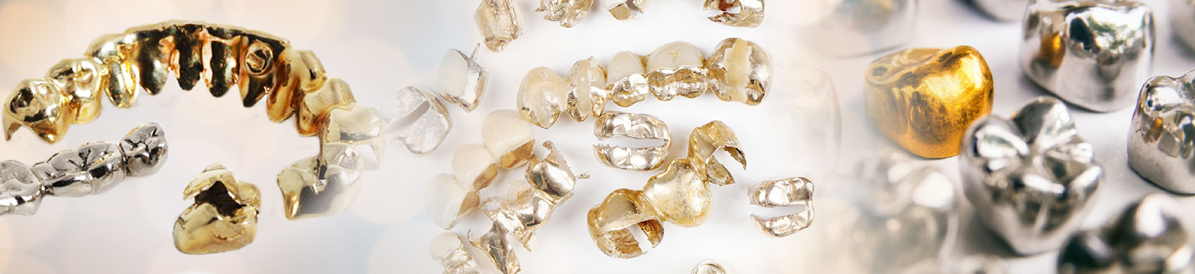 Sell Dental Gold & Scrap Online Get the Best Value for Your Gold Crowns and Dental Gold