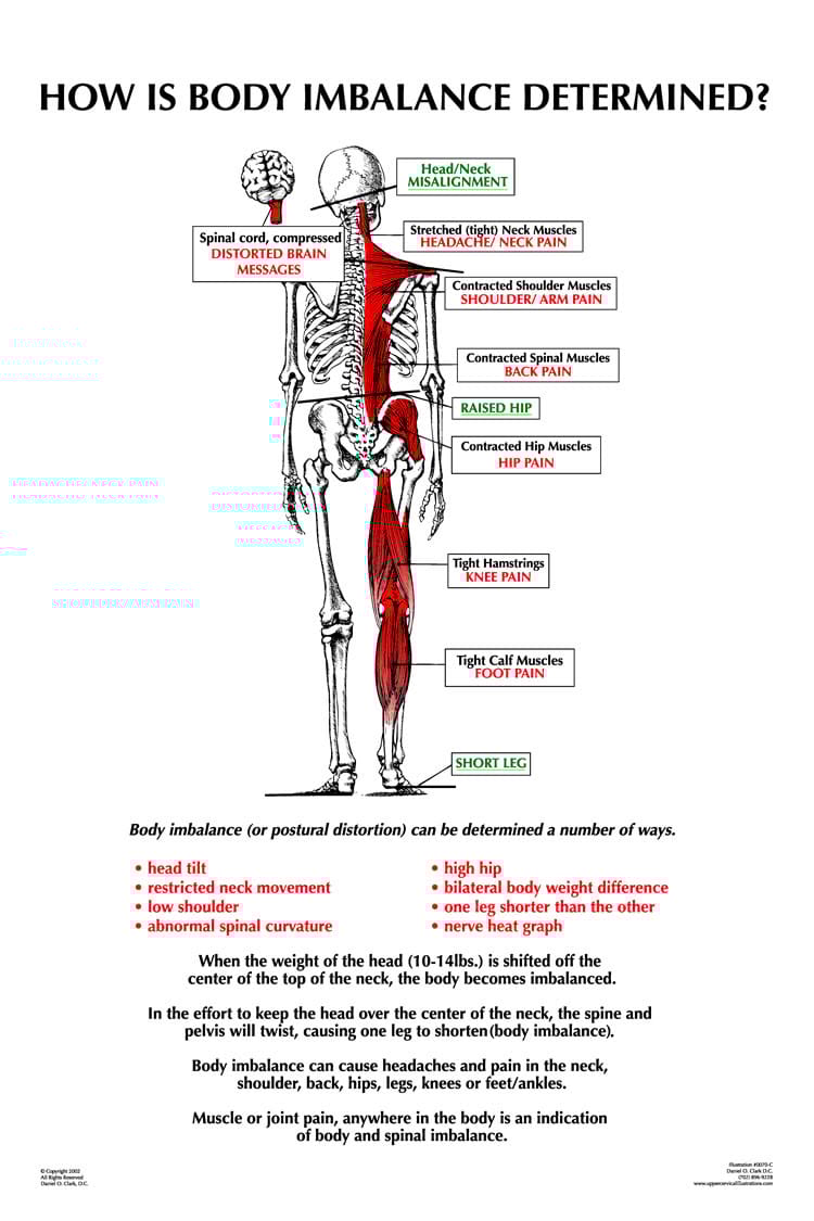 The (Dys)Functional Short Leg Precision Chiropractic