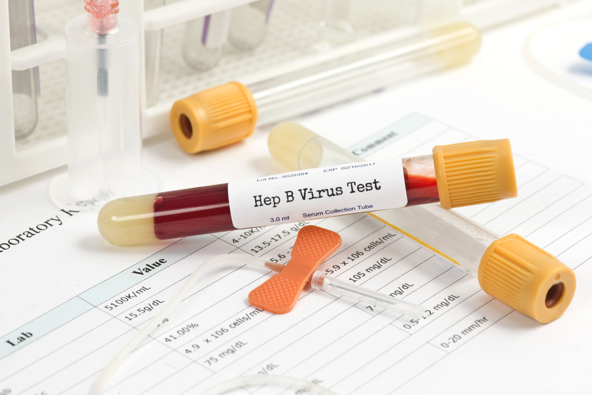 What Can You Detect From a Blood Test? Precision Labs