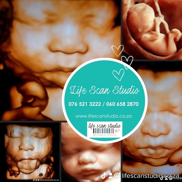 » 2D, 3D/4D & 5D/HD Pregnancy Ultrasounds