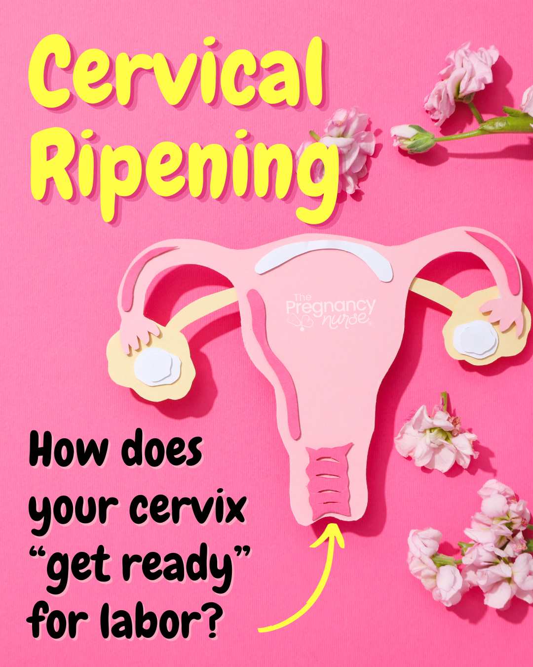 What is Cervical Ripening? The Pregnancy Nurse®