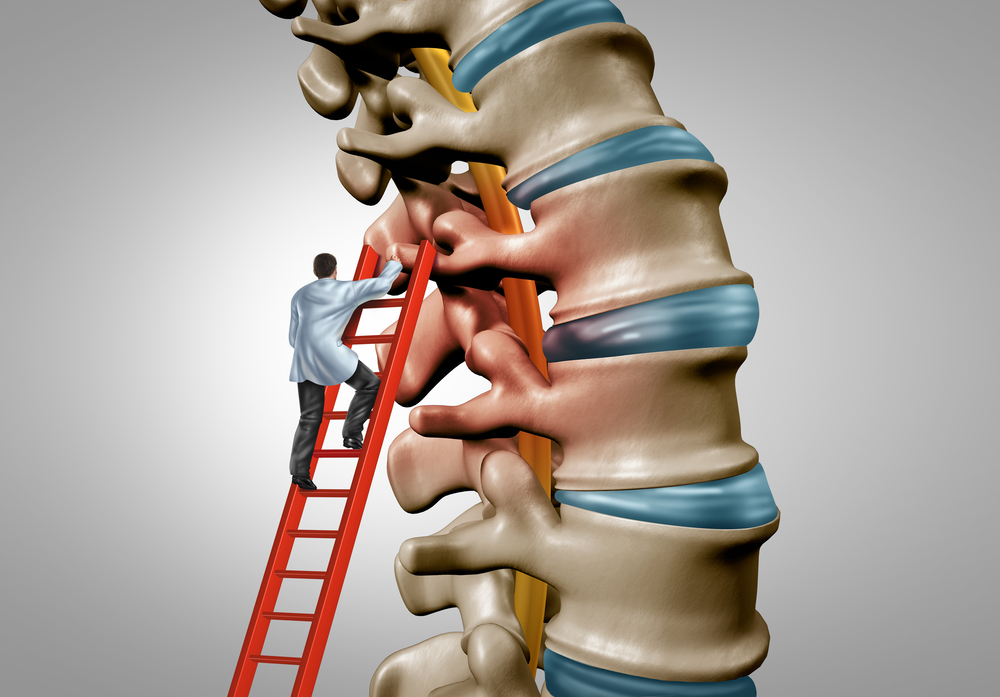 What Are The Final Stages of Spinal Stenosis? Premia Spine