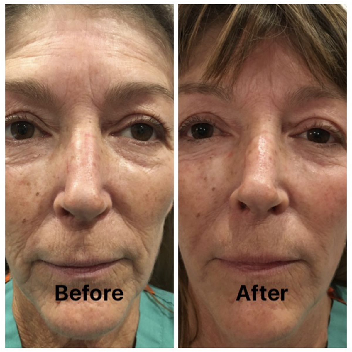 Gallery Fort Myers Premiere Aesthetics