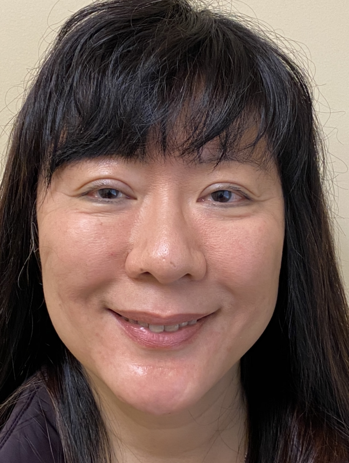 Silhouette Lift Thread LiftPalo AltoSanMateoLos Gatos