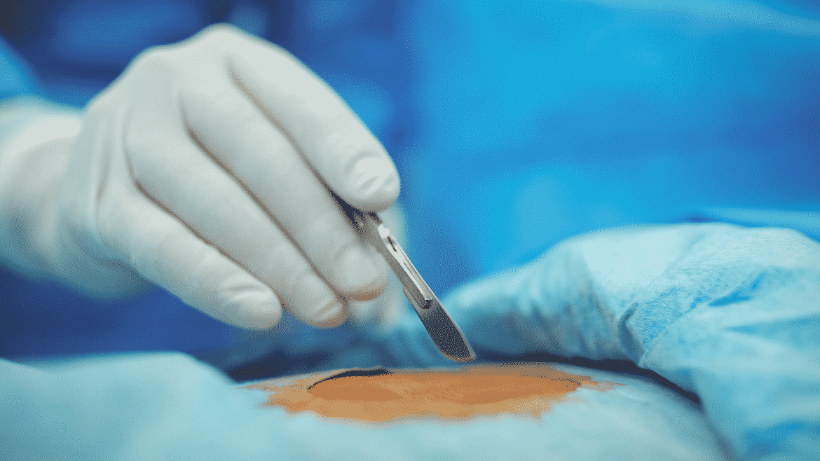 Mohs' Surgery {{Premier Procedural Dermatology}}