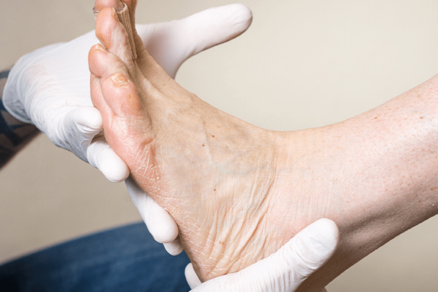 Custom Orthotics Physical Therapy Services in Chicago, IL