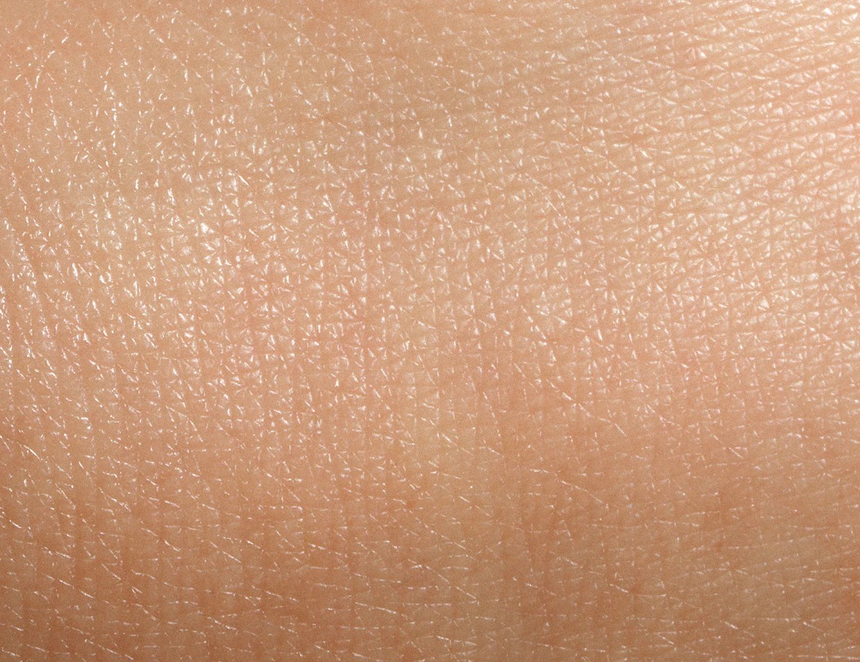 What Is A Normal Skin Type? Key Characteristics Prequel