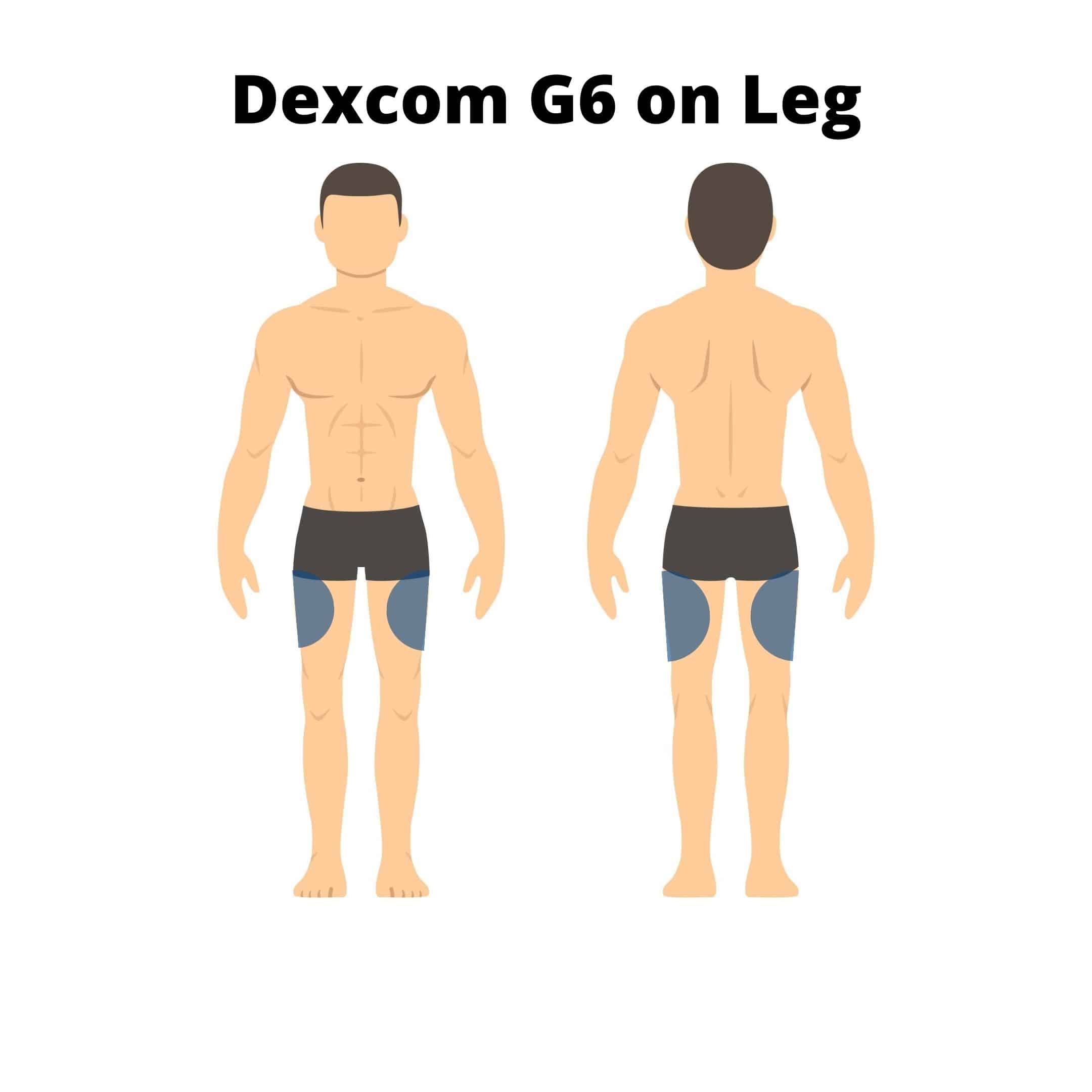 Where to Put G6 on Leg? PostureInfoHub