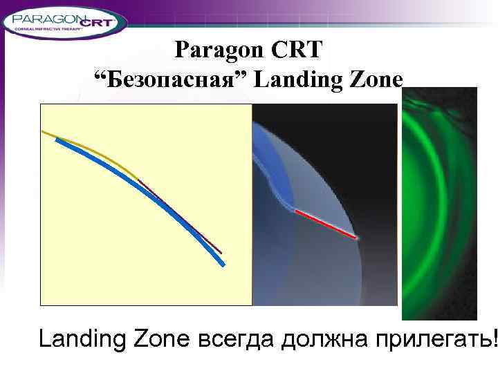 Paragon CRT FDA Approval 13 июня 2002