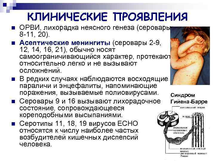 ПИКОРНАВИРУСЫ Таксономия Picornaviridae Enterovirus Rhinovirus ВИРУСЫ