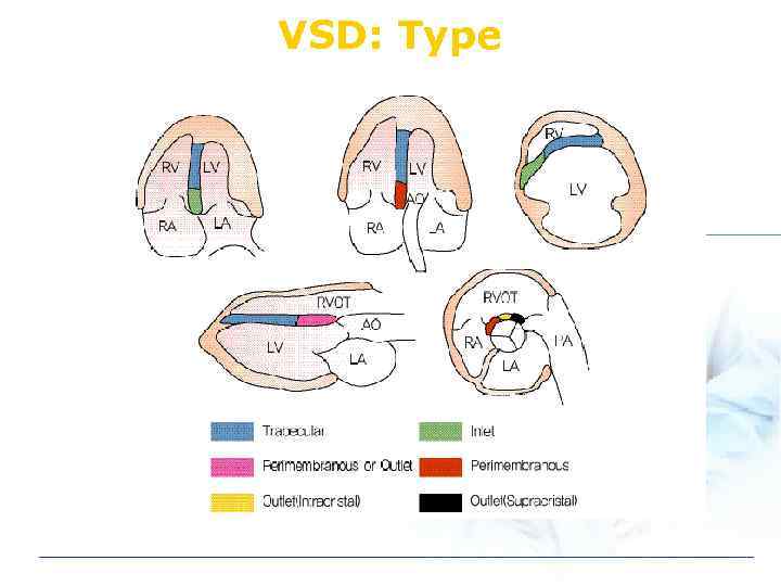 Congenital Heart Disease Adult CHD is not
