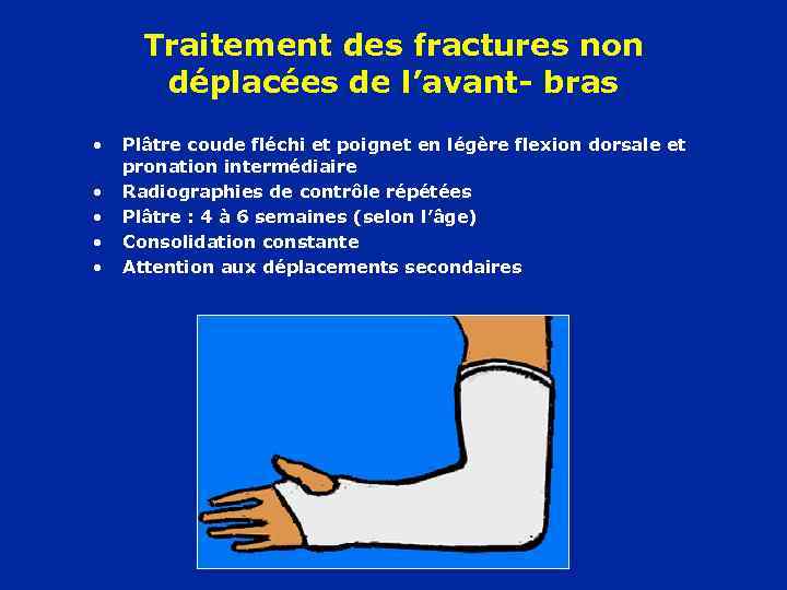 Fractures de l avantbras La pronosupination Pronation intermédiaire