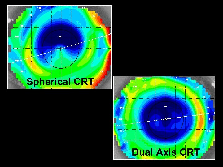 Paragon CRT Dual Axis Ещё один шаг в