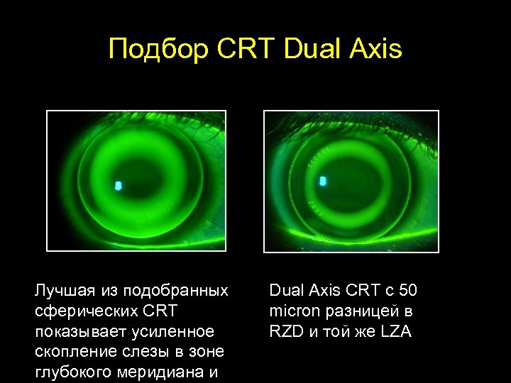 Paragon CRT Dual Axis Ещё один шаг в