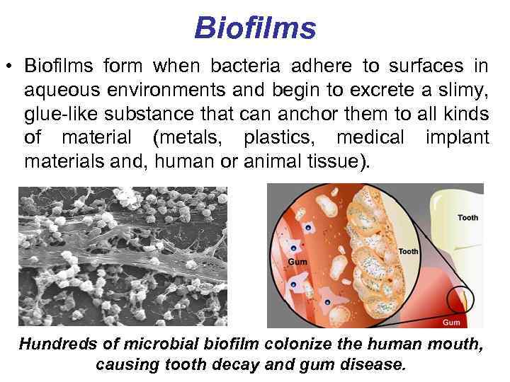 INFECTION AND INFECTIOUS PROCESS 1 Infection Classification of