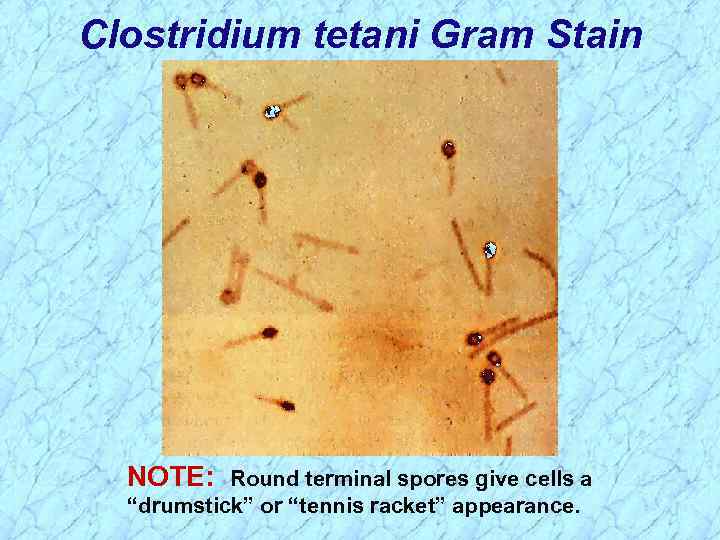 Clostridium See Lecture Handouts Spores Ø