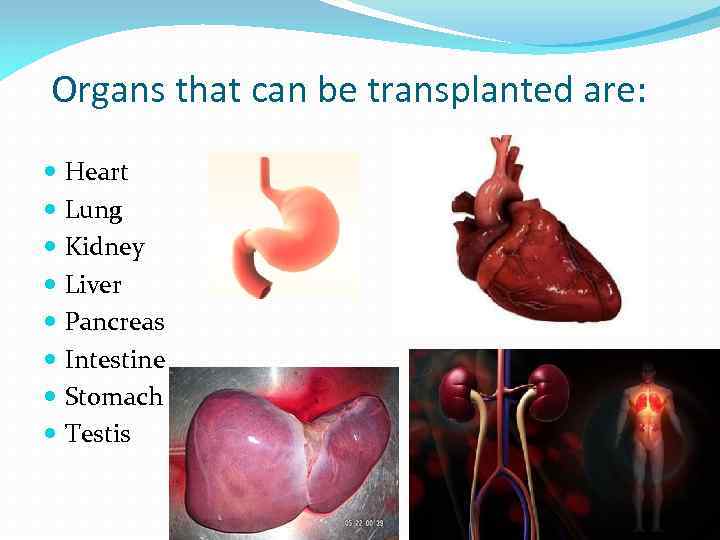 Organ transplantation Organ transplantation is the moving