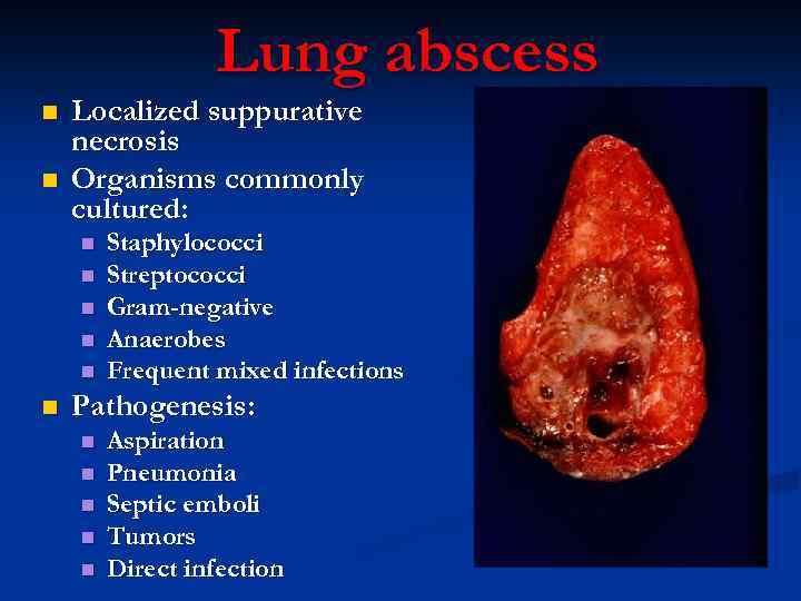 LUNG Diseases Function of the Respiratory System