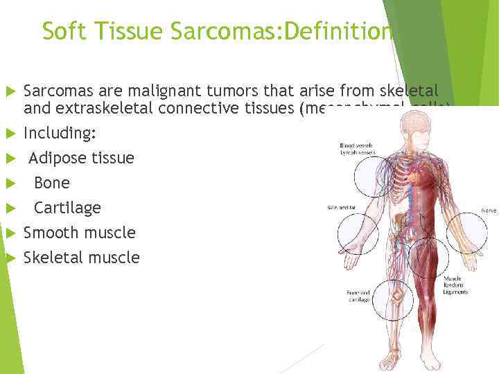 of soft tissue Dr Olga Vornicova Oncology