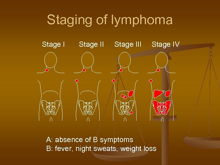Lymphoma Haematological Neoplasia — Overview n Leukemias