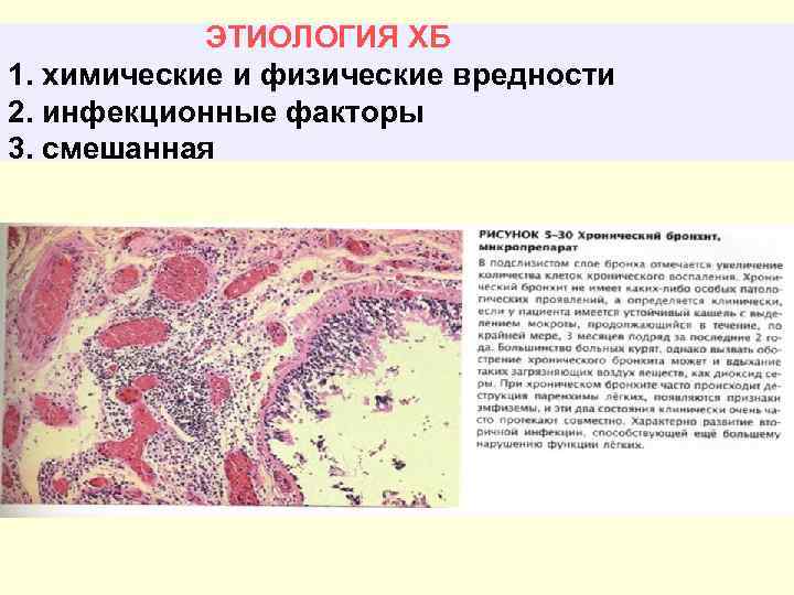 ХРОНИЧЕСКИЕ НЕСПЕЦИФИЧЕСКИЕ ЗАБОЛЕВАНИЯ ЛЕГКИХ ЛЕКЦИЯ Проф Л В