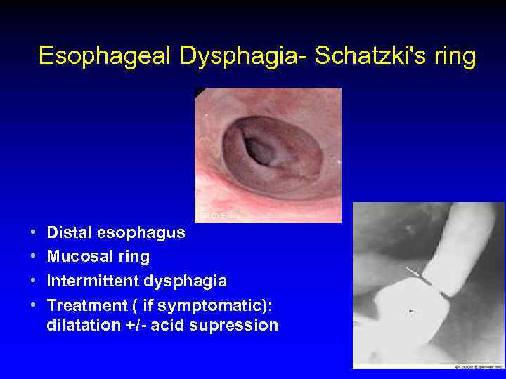 Esophagus Rita Brun MD Gastroenterology Department Rambam Health