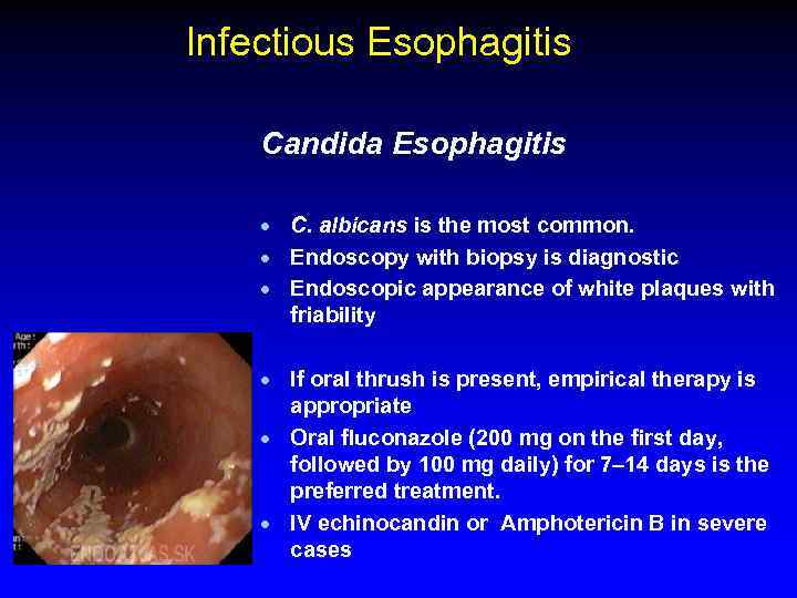 Esophagus Rita Brun MD Gastroenterology Department Rambam Health