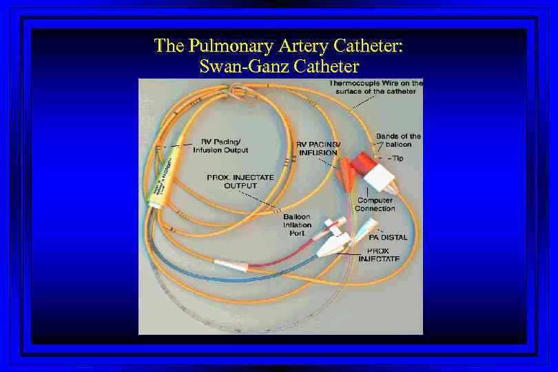 Right Heart Catheterization SwanGanz Catheter SwanGanz Catheter
