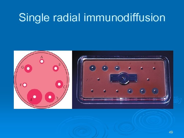 Immunoprecipitation 1 Definition of Immunology Ø The
