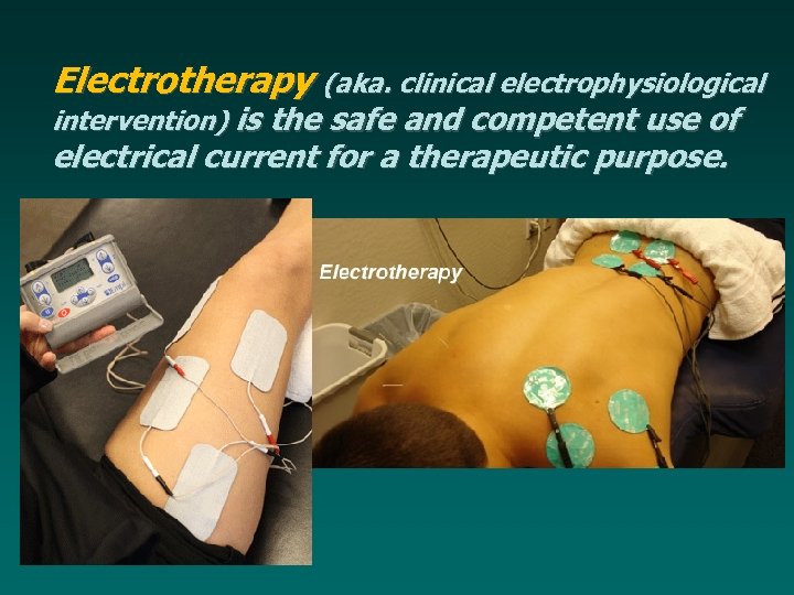 Electrotherapy aka clinical electrophysiological intervention is the safe