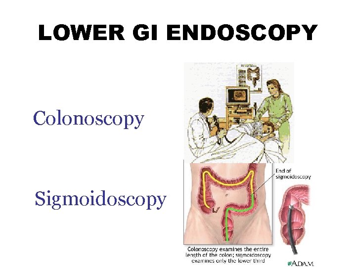 ENDOSCOPY CONTENTS History What is endoscopy